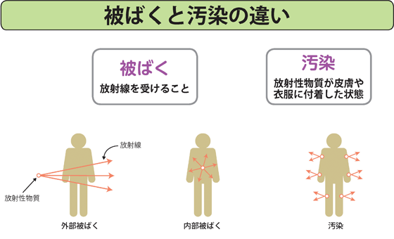 被ばくと汚染の違い
