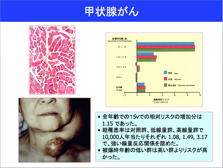 症状 ん 甲状腺 が